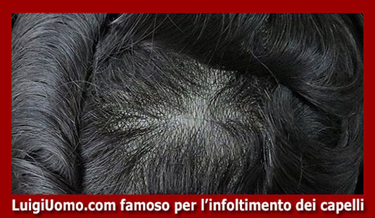 12-Protesi-di-capelli-per-uomo-donna-per-uomo-donna-vip-in-lace-skin-poliuretano-pu-monofilamento-silicone-impianto-luigiuomo-